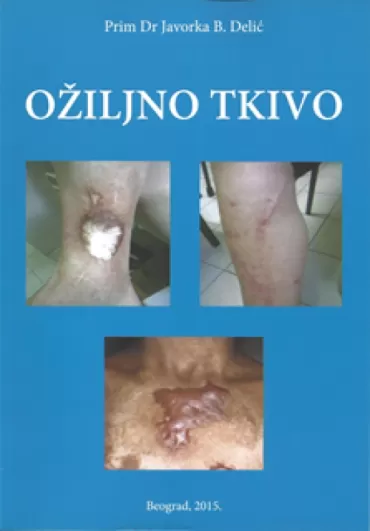 ožiljno tkivo javorka b delić